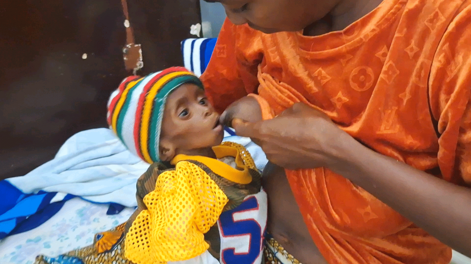 Dubréka : la malnutrition de zéro à cinq ans, une réelle menace pour les enfants !